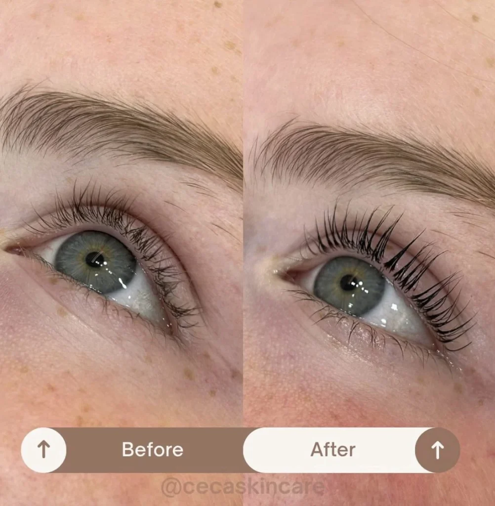 Lash lift